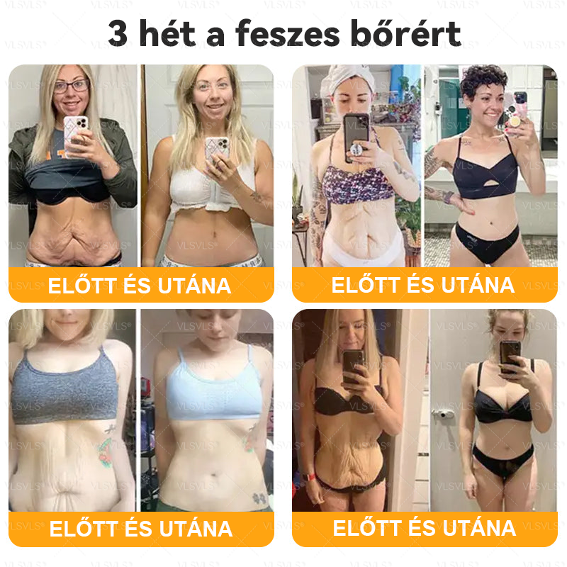 VLSVLS® Méhméreg Bőrhelyreállító Krém 🔥 UTOLSÓ NAP – 80% KEDVEZMÉNY