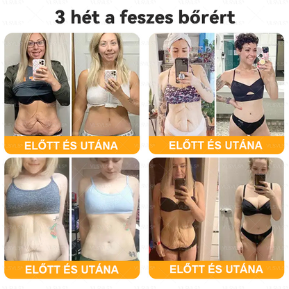 VLSVLS® Méhméreg Bőrhelyreállító Krém 🔥 UTOLSÓ NAP – 80% KEDVEZMÉNY