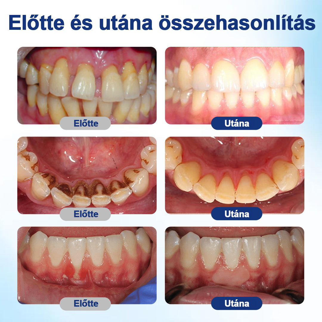 HEATWOLF® BeeTakt Szájápoló Regeneráló Oldat 🦷Fejlett bioaktív formula a szájüreg átfogó regeneráló támogatására