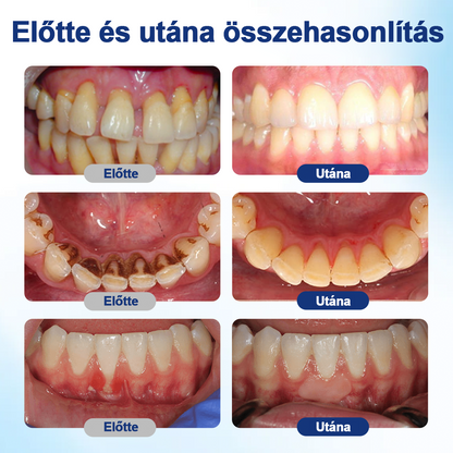 HEATWOLF® BeeTakt Szájápoló Regeneráló Oldat 🦷Fejlett bioaktív formula a szájüreg átfogó regeneráló támogatására