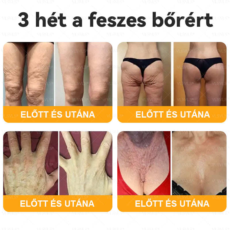 VLSVLS® Méhméreg Bőrhelyreállító Krém 🔥 UTOLSÓ NAP – 80% KEDVEZMÉNY