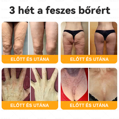 VLSVLS® Méhméreg Bőrhelyreállító Krém 🔥 UTOLSÓ NAP – 80% KEDVEZMÉNY