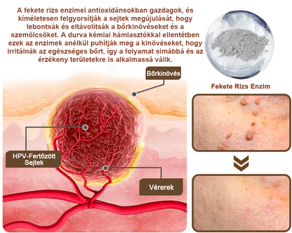 Pureluxo® Fekete Rizses Bőrregeneráló Krém 👨‍⚕️ (Szemölcsök, bőrkinövések, foltok és hiperpigmentáció kezelésére)
