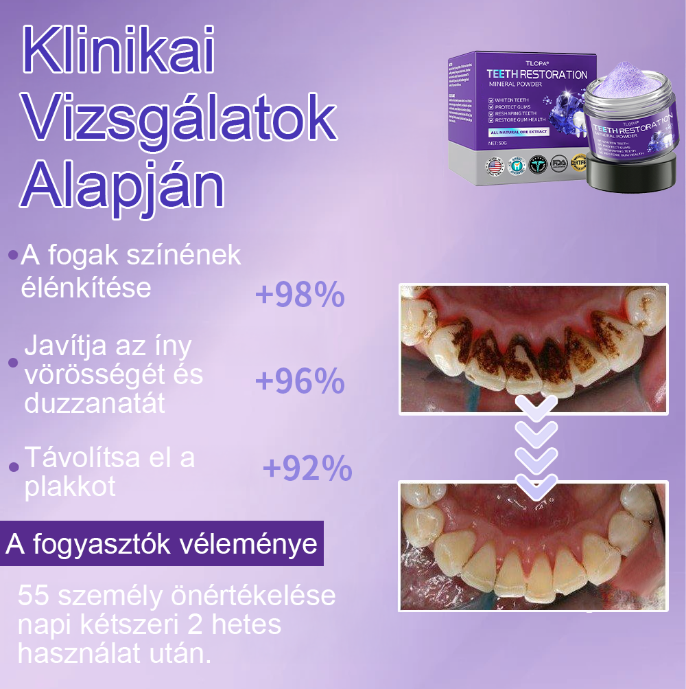 Cvreoz® Fogápoló Ásványi Por — 🦷Vége a lüktető fogfájásnak, érzékeny fogaknak és gyenge zománcnak, már az első használatok után (FDI ajánlott)