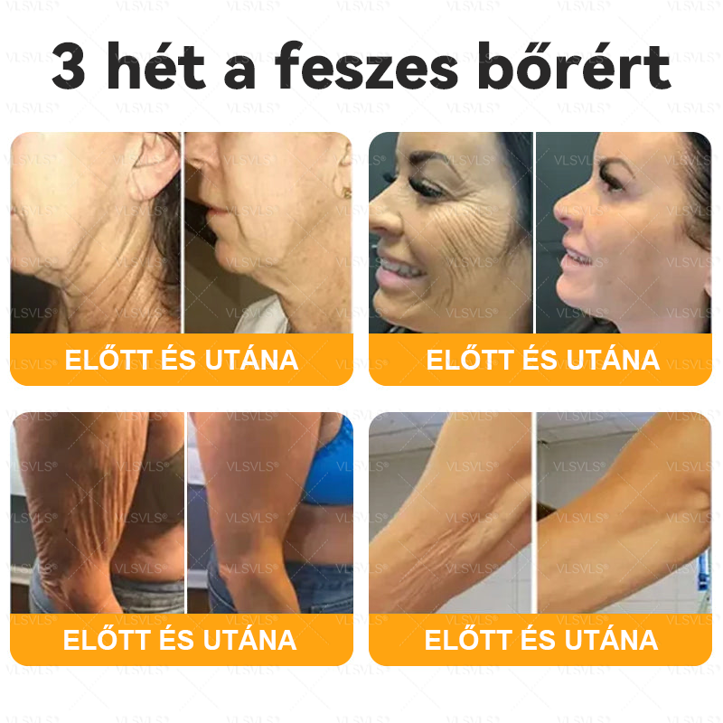 VLSVLS® Méhméreg Bőrhelyreállító Krém 🔥 UTOLSÓ NAP – 80% KEDVEZMÉNY