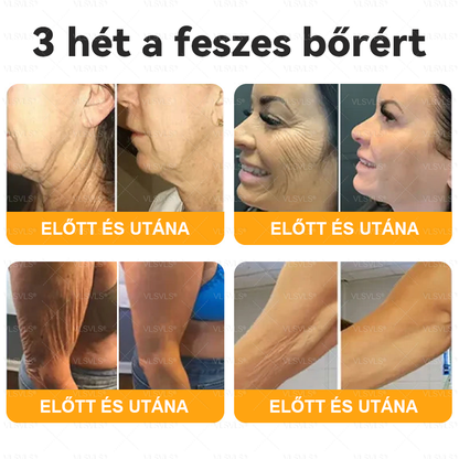 VLSVLS® Méhméreg Bőrhelyreállító Krém 🔥 UTOLSÓ NAP – 80% KEDVEZMÉNY