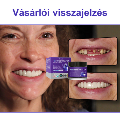 Cvreoz® Fogápoló Ásványi Por — 🦷Vége a lüktető fogfájásnak, érzékeny fogaknak és gyenge zománcnak, már az első használatok után (FDI ajánlott)