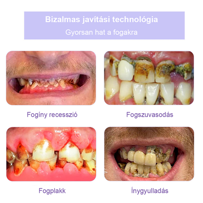Cvreoz® Fogápoló Ásványi Por — 🦷Vége a lüktető fogfájásnak, érzékeny fogaknak és gyenge zománcnak, már az első használatok után (FDI ajánlott)