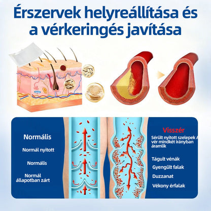 Healrize® Vénacélpont mikrotűs tapasz⚡Azonnali enyhülés hosszú távú eredmények🇭🇺