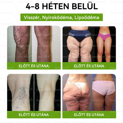 Ajánlott a Semmelweis Kórház által · BENU hivatalos üzlet| 👩‍⚕️ 𝐆𝐞𝑒𝐿𝑒𝐦𝐨𝐧® Glumasetide 8 az 1-ben Karcsú és Egészséges Nano Mikrotűs Tapasz